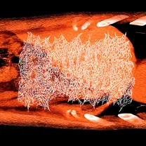 Beurre - Resonate And Amplify