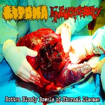 Lipoma - Rotten Bloody Bowels of Eternal Disease