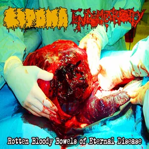 Lipoma - Rotten Bloody Bowels of Eternal Disease