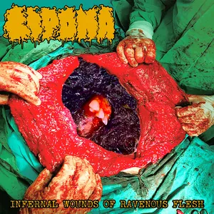Lipoma - Infernal Wounds of Ravenous Flesh
