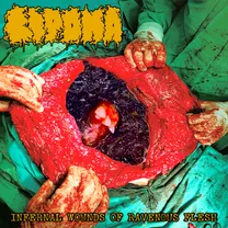 Lipoma - Infernal Wounds of Ravenous Flesh